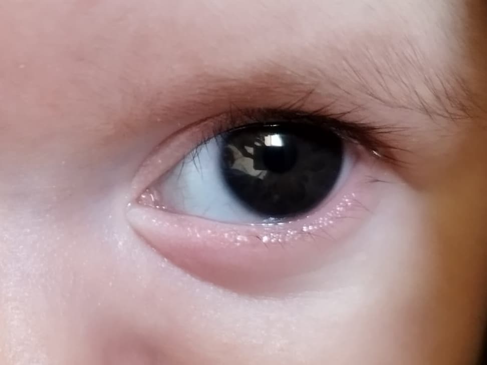 Sguardo 1